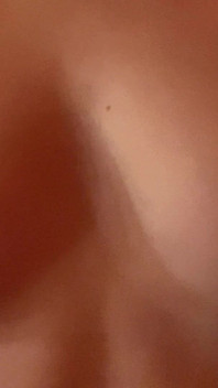 Tillbe mina bröst och bröstvårtor