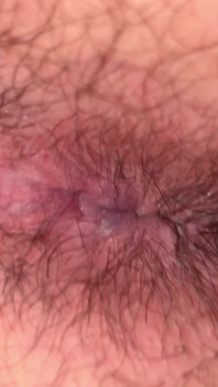 Close up Hairy Hole