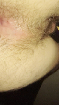 Close up of My Hole