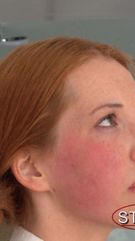 A Faceslapping for Alora