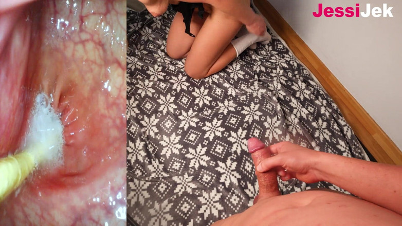 JessiJek: Glory Asshole Knulla med Endoscope het spermastorm täcker hans ansikte...