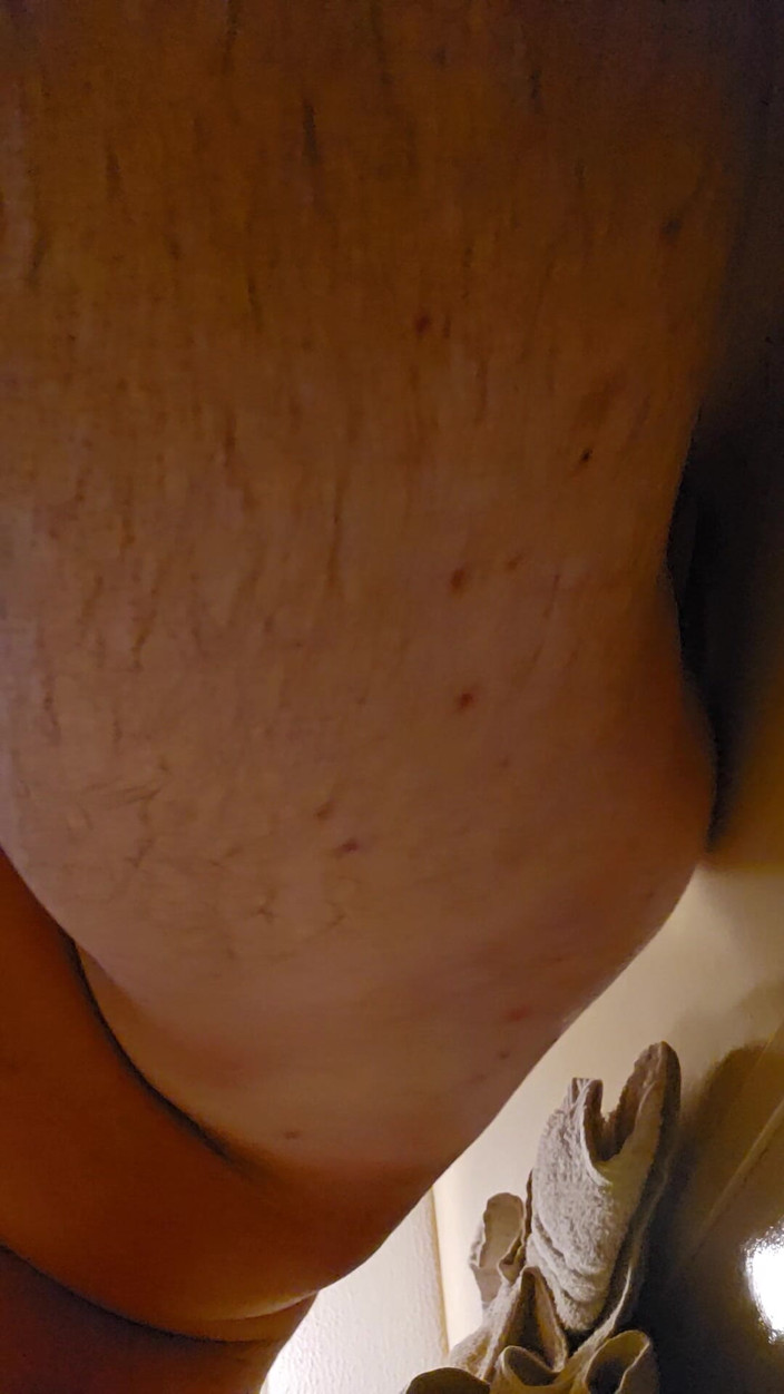 Backshot225: Rada jako Fukk