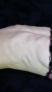 Addicted to My Stretched Belly Button