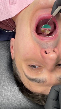Nurse Bunny Checks Dr. Canada's Teeth Multi Angle