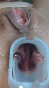Exame anal
