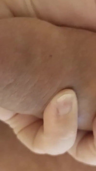 Bastonul gros.. un penis foarte gros.