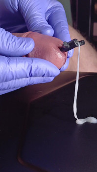 A Gay Dream Comes True, a Dilator in the Devil's Hands