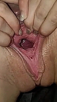 후