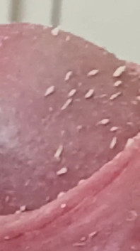 Smegma Foreskin Roll. bigpisser