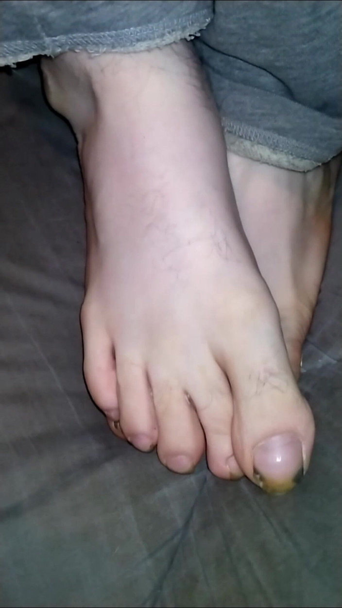 Au79: Foot Fancies
