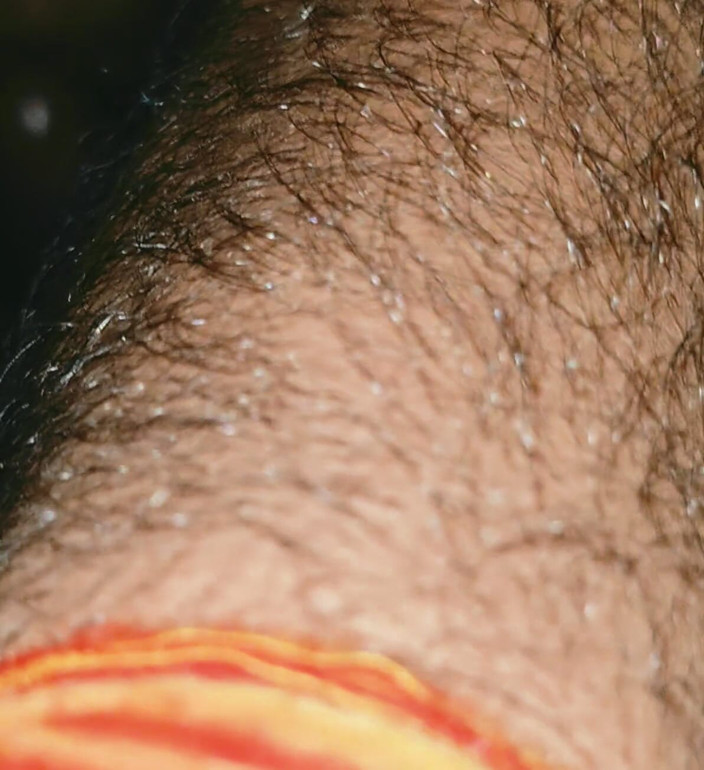 anurag11111: Zungenanal mit kehlenfick-blowjob