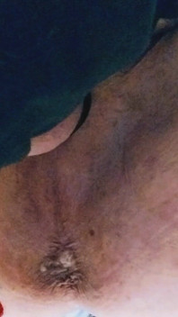 Park and Ride Breeding.