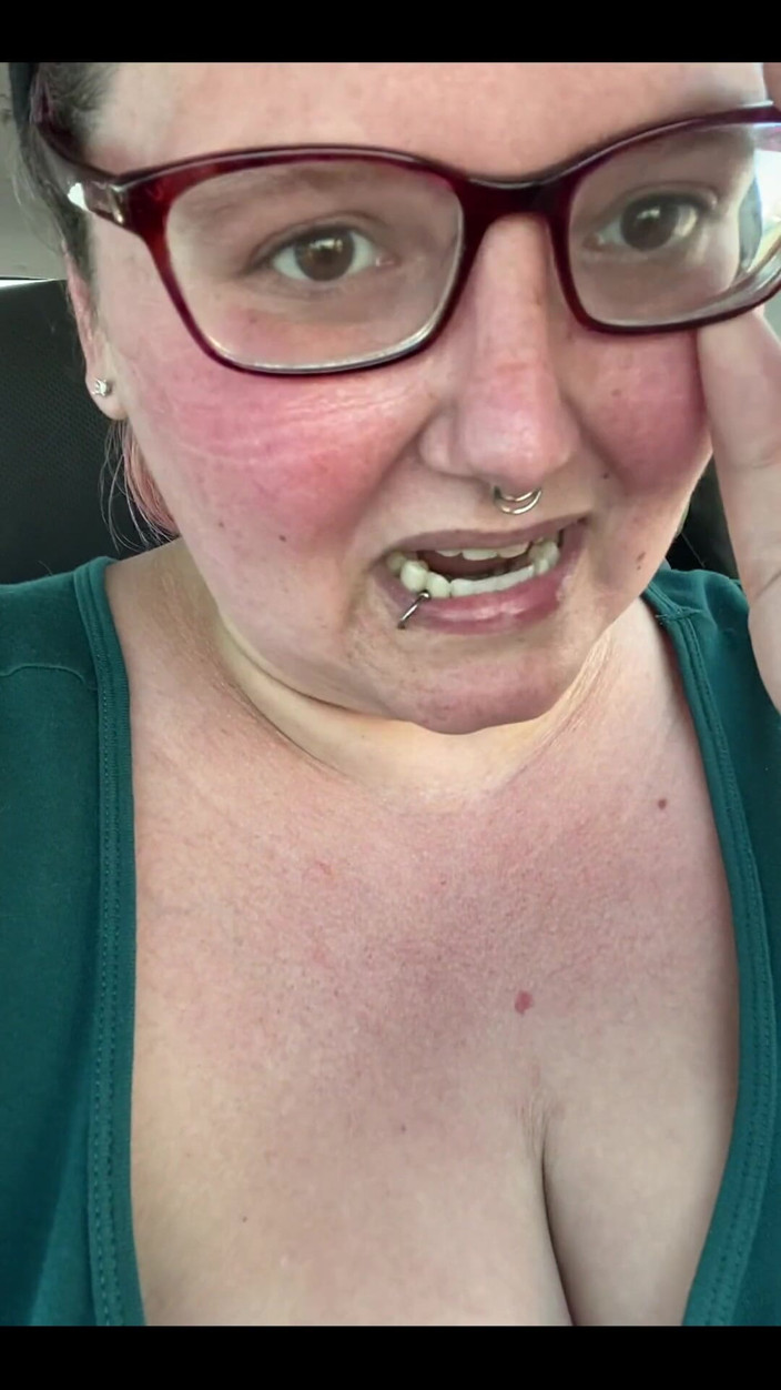 Sara Star: Ich habe einen Sonnenbrand für Art Supplies!