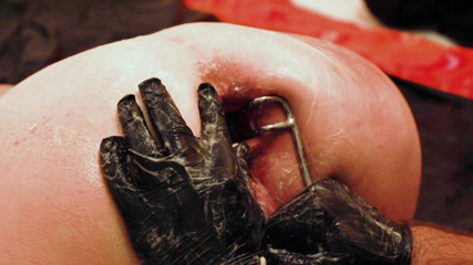 Marcus Pollack: Massive speculum stretching of her little pink ass