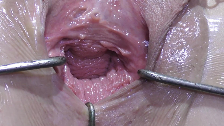 deep keely: Aberta