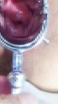 Bondage Cusco Espansione della Vagina Allenamento Anale 1/2
