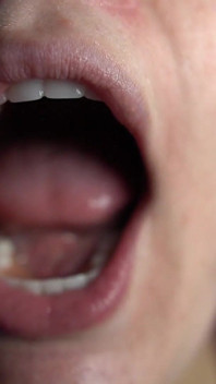 Tour pela boca com dentaduras
