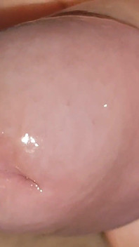 Dịch Niệu Đạo Với Lượng Lớn Sẽ Làm Nó Trơn Trượt.