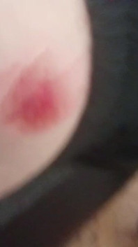 Penis
