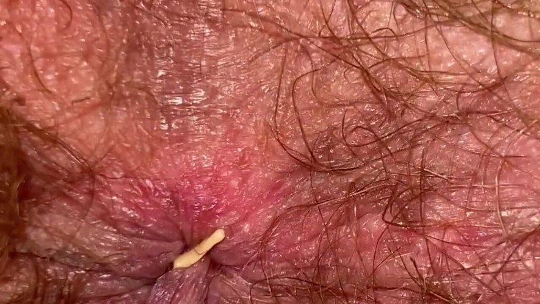 Cuteblonde666: Video fetish pantat berbulu cewek dengan itil besar close-up!