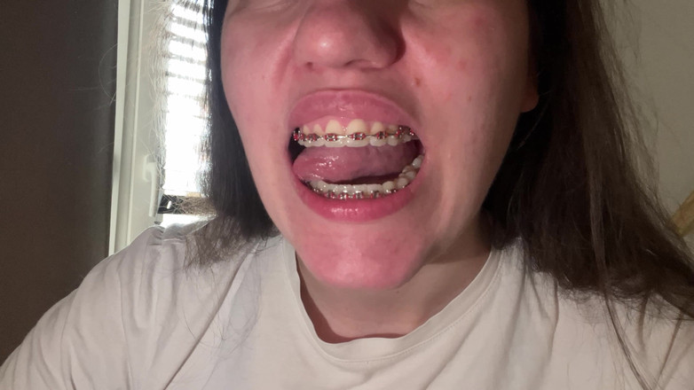 NicoleRay: 舌で矯正器具を舐める