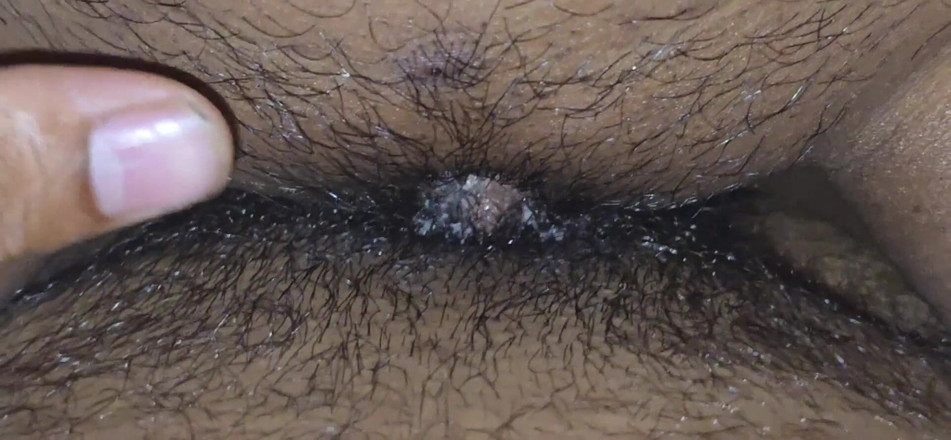 SafeRosebush8: クローズアップ デジファック