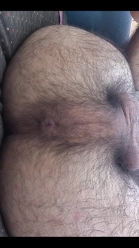 My Asshole in Close-up