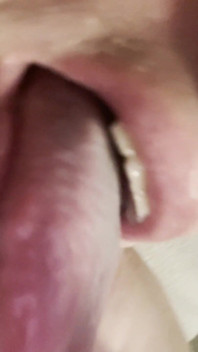 Mad for Tongue