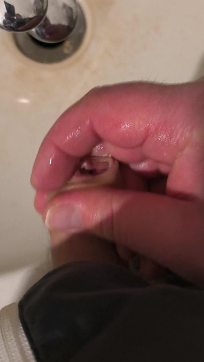 Uglydick: Wixx moche dans la réserve