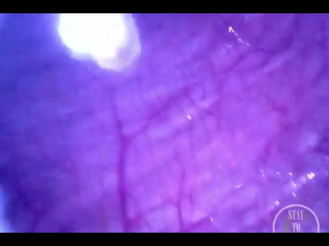 Lina Free: Bombeando aire en mi vejiga llena con la minicam adentro