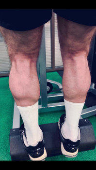 My Legs