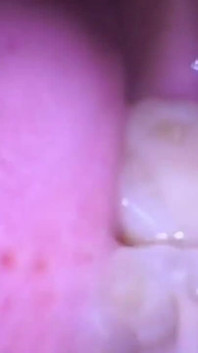 Deep Inside Sydney's Mouth - Sydney Screams Shows off Mouth, Tongue, Throat, and Uvula with Endoscope