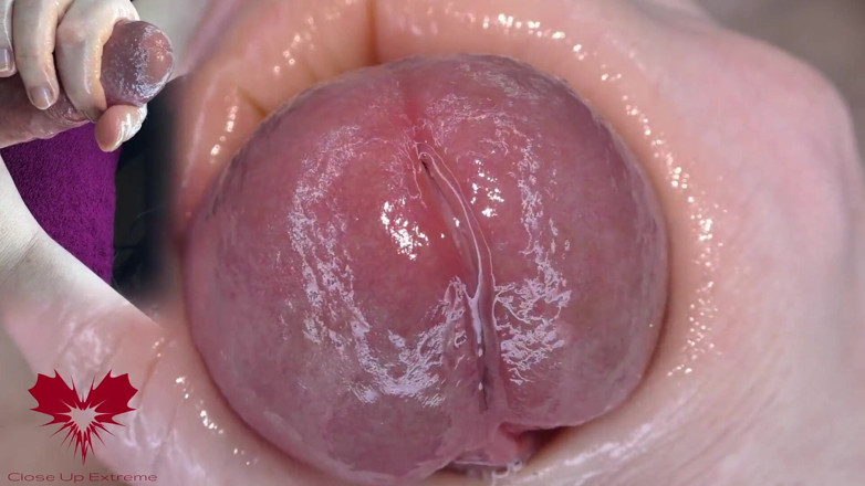 Close Up Extreme: Super Close-up of the Glans. Urethral Games with the Dilator.