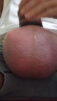 Anelli in silicone e salina