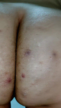 Le Cul Juteux De Nicole En Cellulite Et Taquinage Poilu