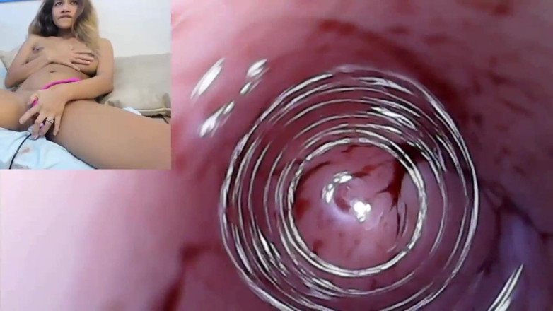 SexyGamingCouple: Endoscopio coño, imágenes de preñada en su mensual con coño...