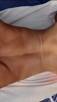 Sunbathing with Wide Open Cheeks - Anal Training by the Pool