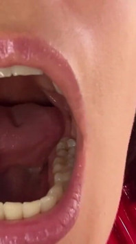 Pemeriksaan Oral PVC