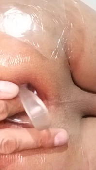 Opening My Ass