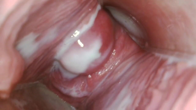 JANA studios: Endoscope in my pussy