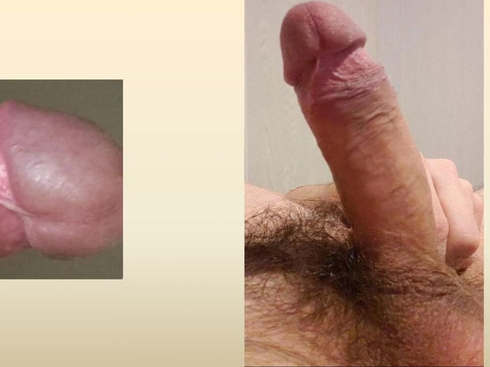 Swimmer00: My penis