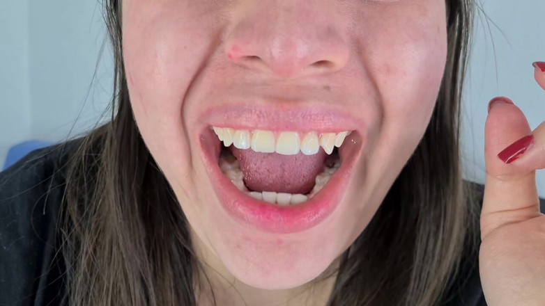 Alice H: Fetish mulut