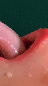 Foreskin: She Gags From Huge Amounts of Sperm, Going Down Her Throat Closeup