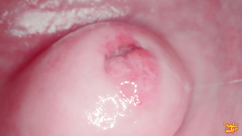 MollyRedWolf: Hey Stepbrother! Let's Play Gynecologist? Gyno, Endoscopy - Mollyredwolf