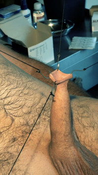 An Artful Study in Needles and Steel