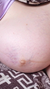 妊娠中のお腹の動きとお腹の手拍子 先月、妊娠中