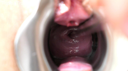 TripleXTransMan: Menembus ServiksKu!