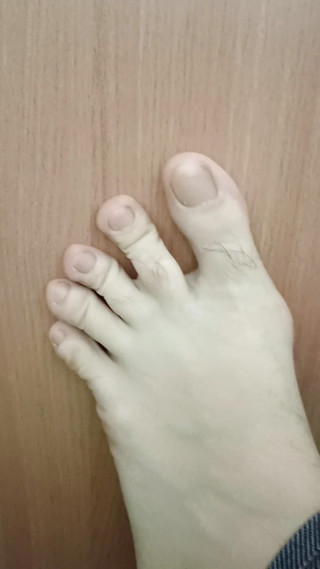 BW_Dolphin: Hairy toes! Natural toe nails, gorgeous soles.