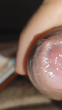 Purge Silencieuse Du Liquide Scrotal Pur.