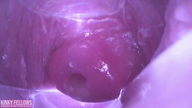 A case of fling: 아시아 천사 26985